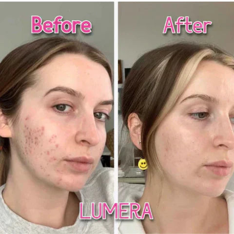 GlowPulse Facial Toning Tool